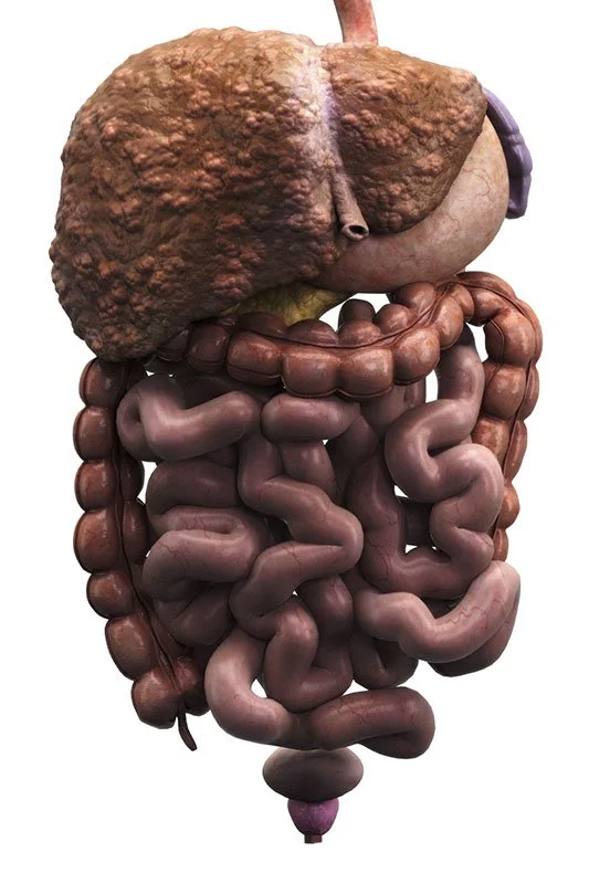 Liver Cirrhosis and Intestines
