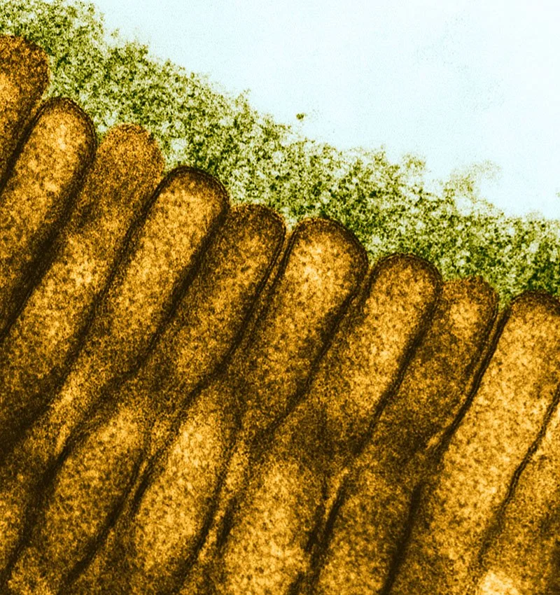 Transmission Electron Micrograph