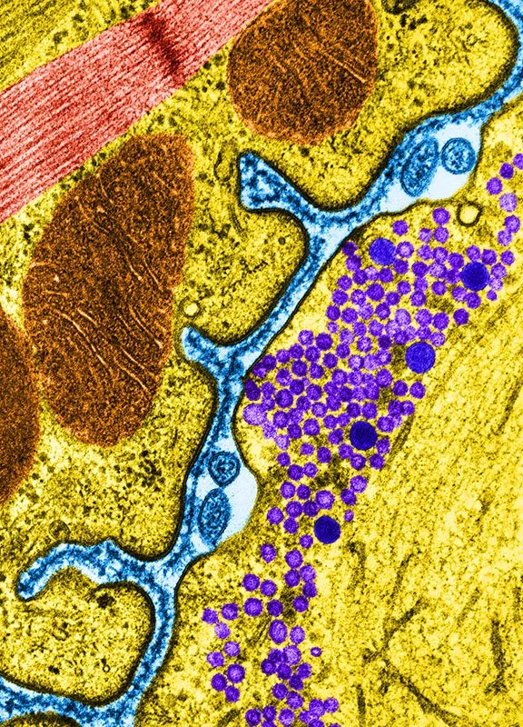 Transmission Electron Micrograph
