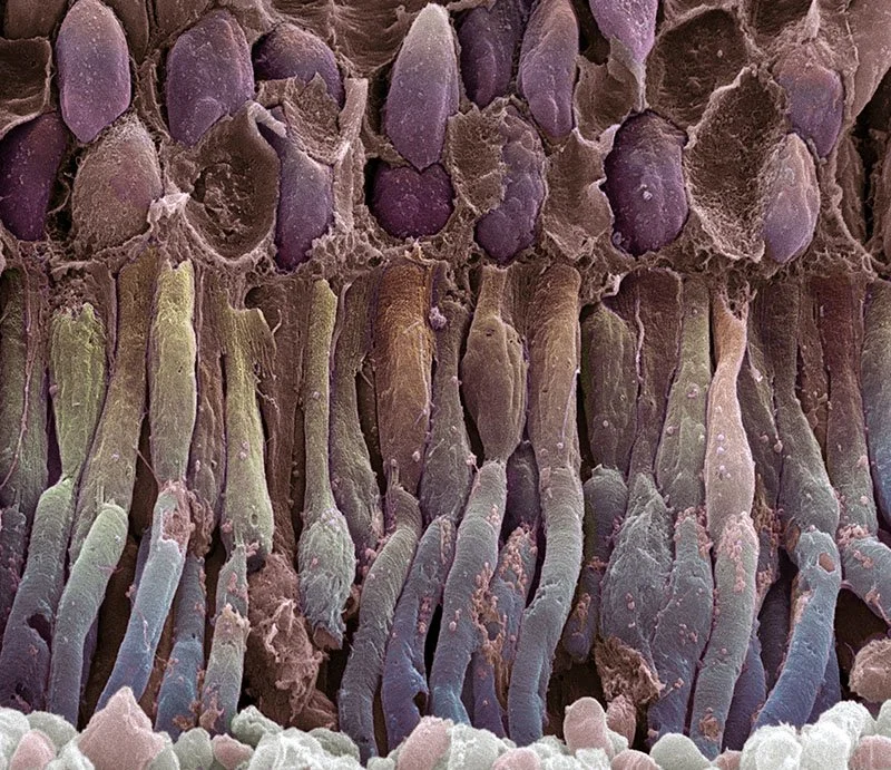 Scanning Electron Micrograph