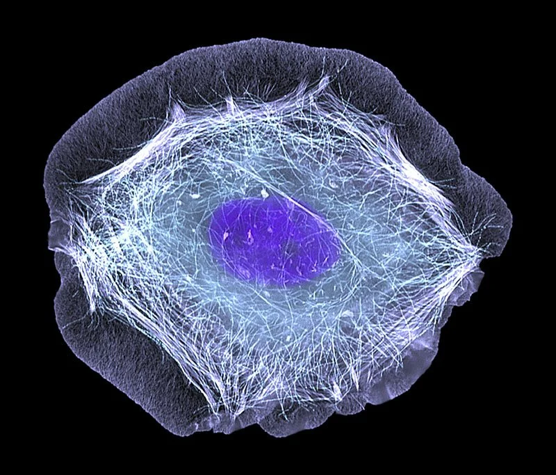Light Micrograph (LM)