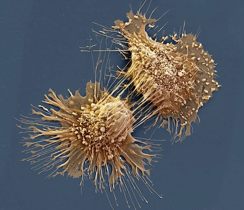 Dividing Cancer Cells, Micrograph