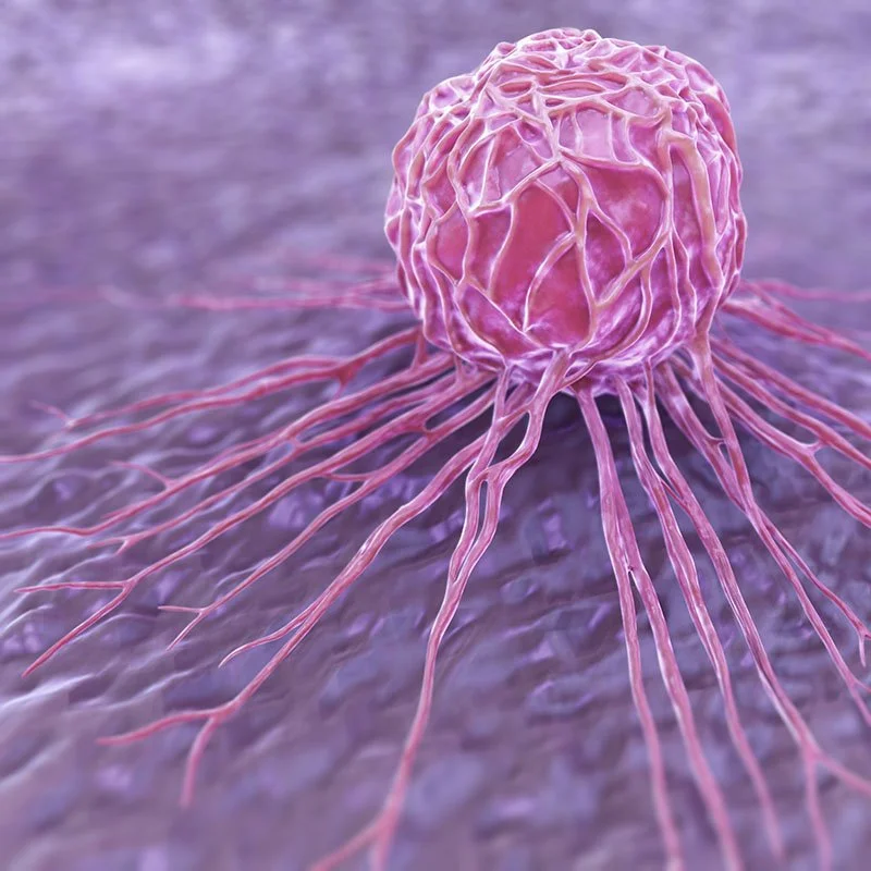 3D Breast Cancer Illustration