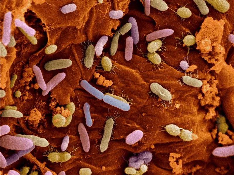 Bateria in Dog Feces