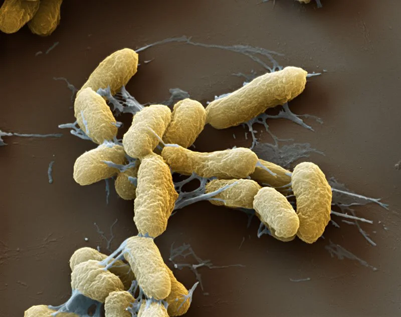 Pague (Yersinia pestis) Bacteria