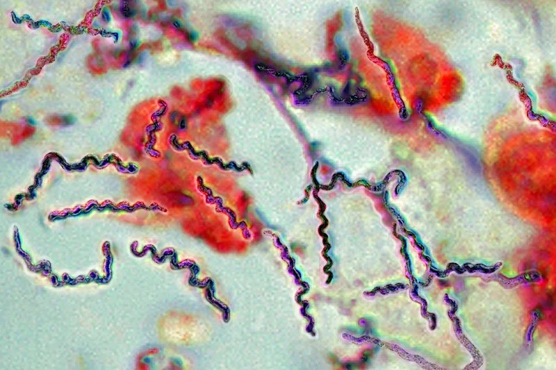Borrelia Bacteria