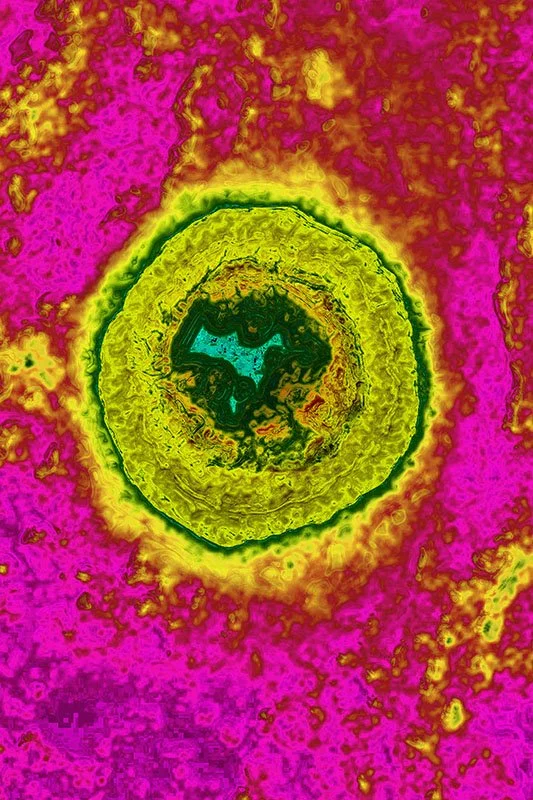 Varicella Zoster Virus
