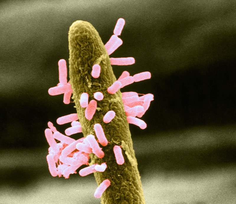 Bacteria Micrograph