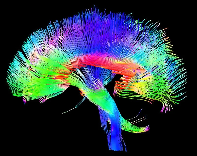 3D Scan of Brain Pathways