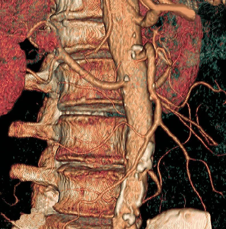 3D CT (Computed Tomography)