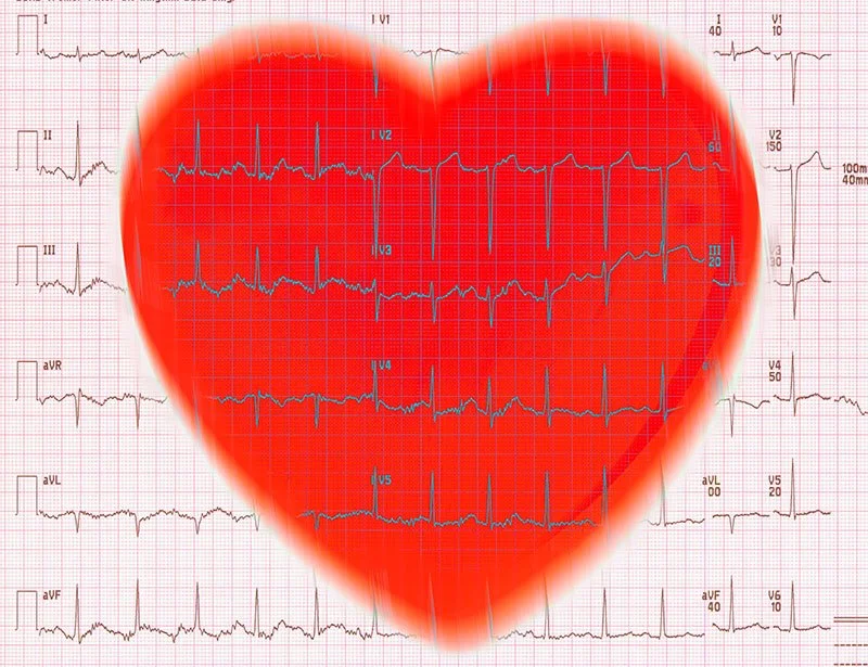 EKG andHeart