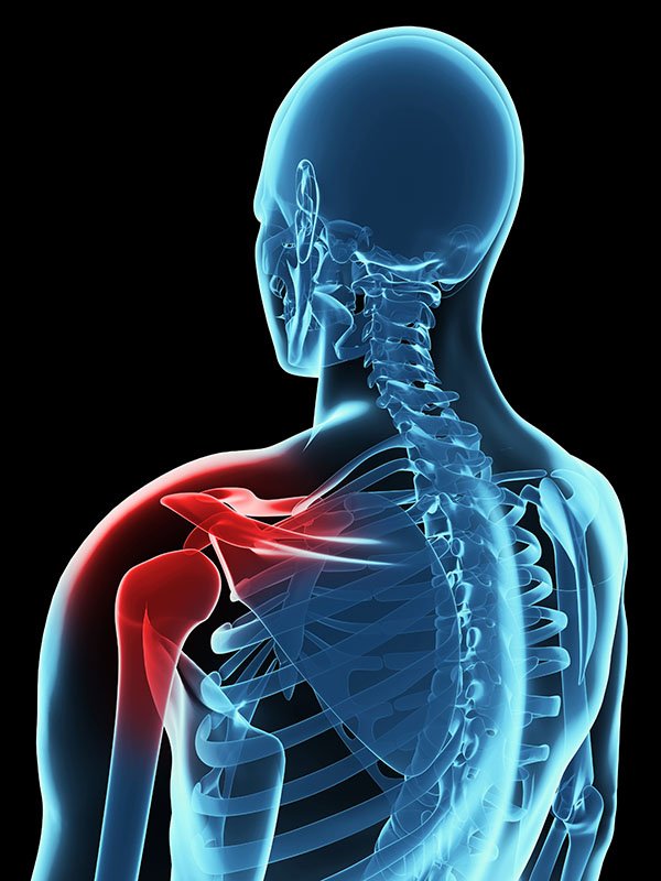 Shoulder Pain