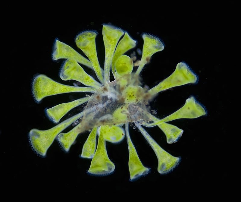 Ciliate Protozoa