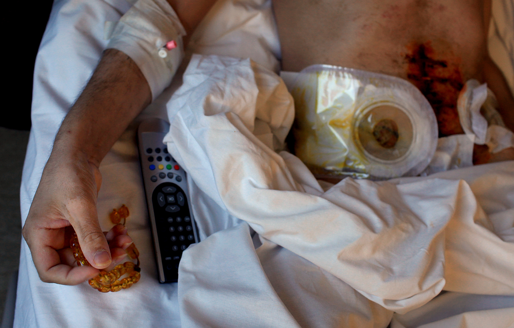  Injured Syrian rebel fighter, Antakya, Turkey 2012 