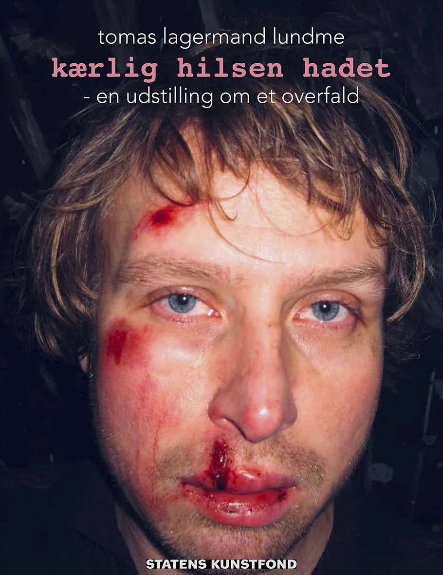 Tomas Lagermand Lundme, Kærlig hilsen hadet, exhibition poster, 2019.