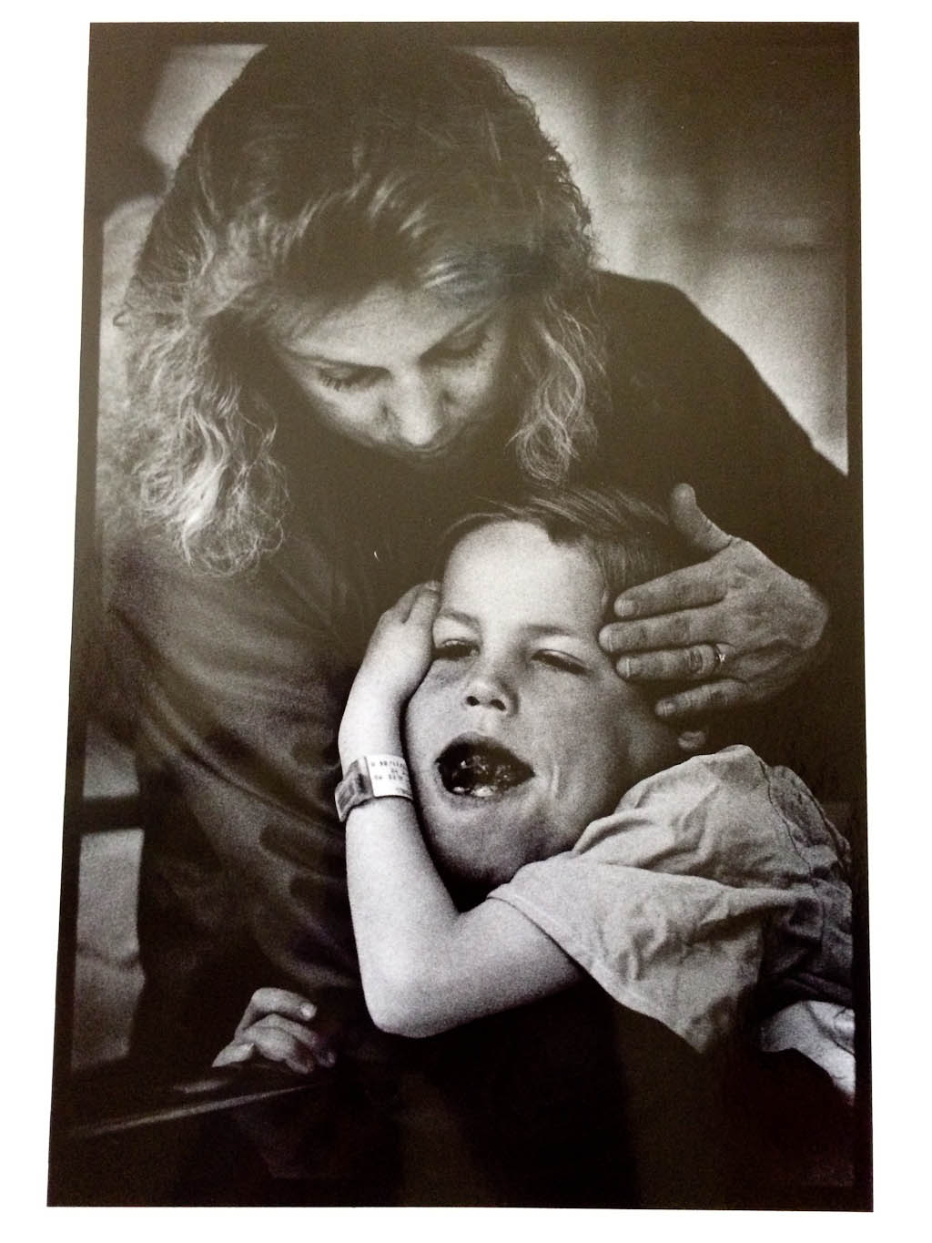Randall and mother just before surgery, NYU Medical Center, 1988-89.