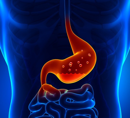 transparent digestive track with stomach acid reflux - Ultimate Health - Personal trainer Studio City