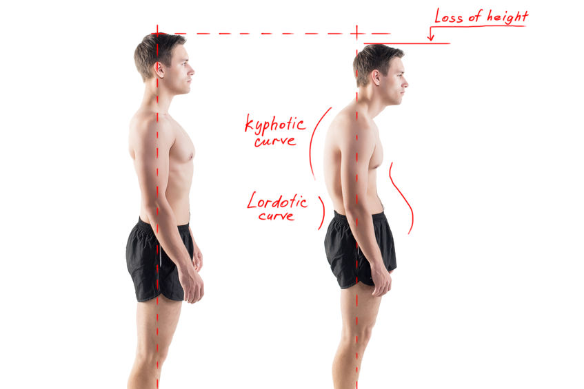 Posture correction - Ultimate Health Personal Training Center - Los Angeles