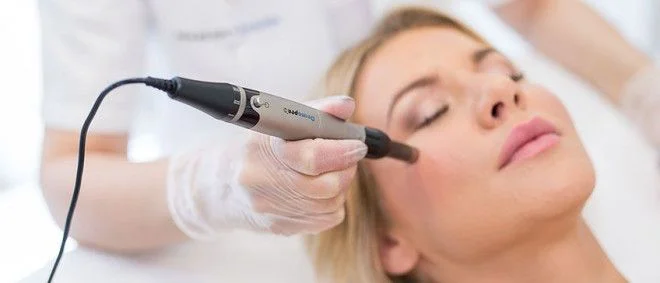 dermapen-micro-needling-skin-therapy-in-abu-dhabi-1-in-al-maqta-5ad59b7190342_slider.jpeg