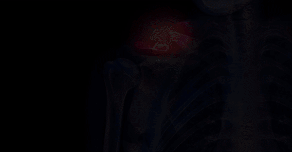 ezgif.com-video-to-gif.gif