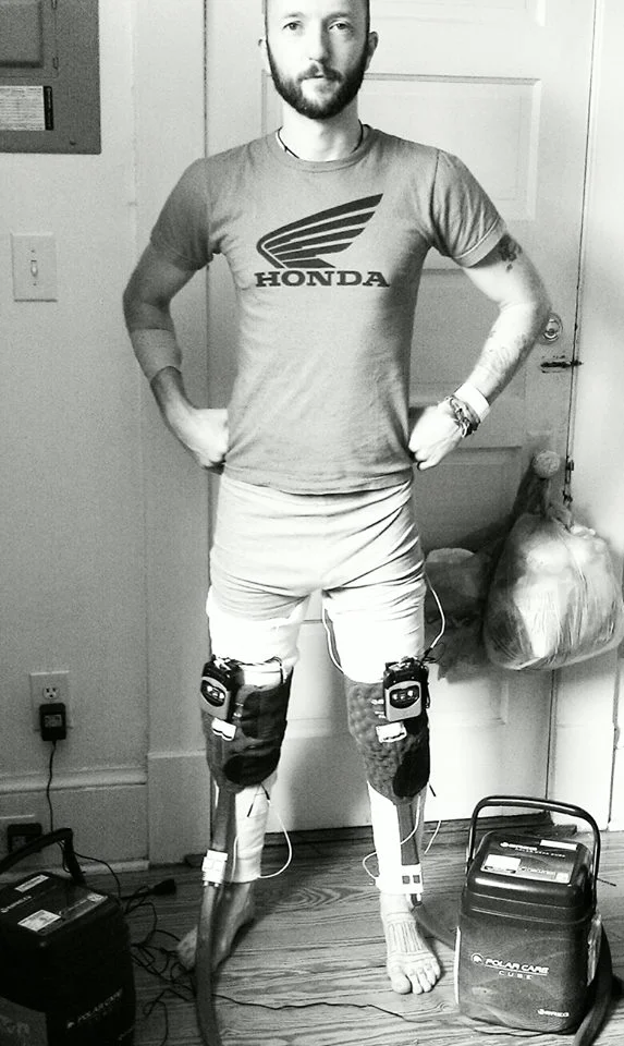 Rob (Heavy-D) is getting ready to own summer. Stage 1 of his super-enhanced Voltron knee implants have been installed. Space monsters, beware. 