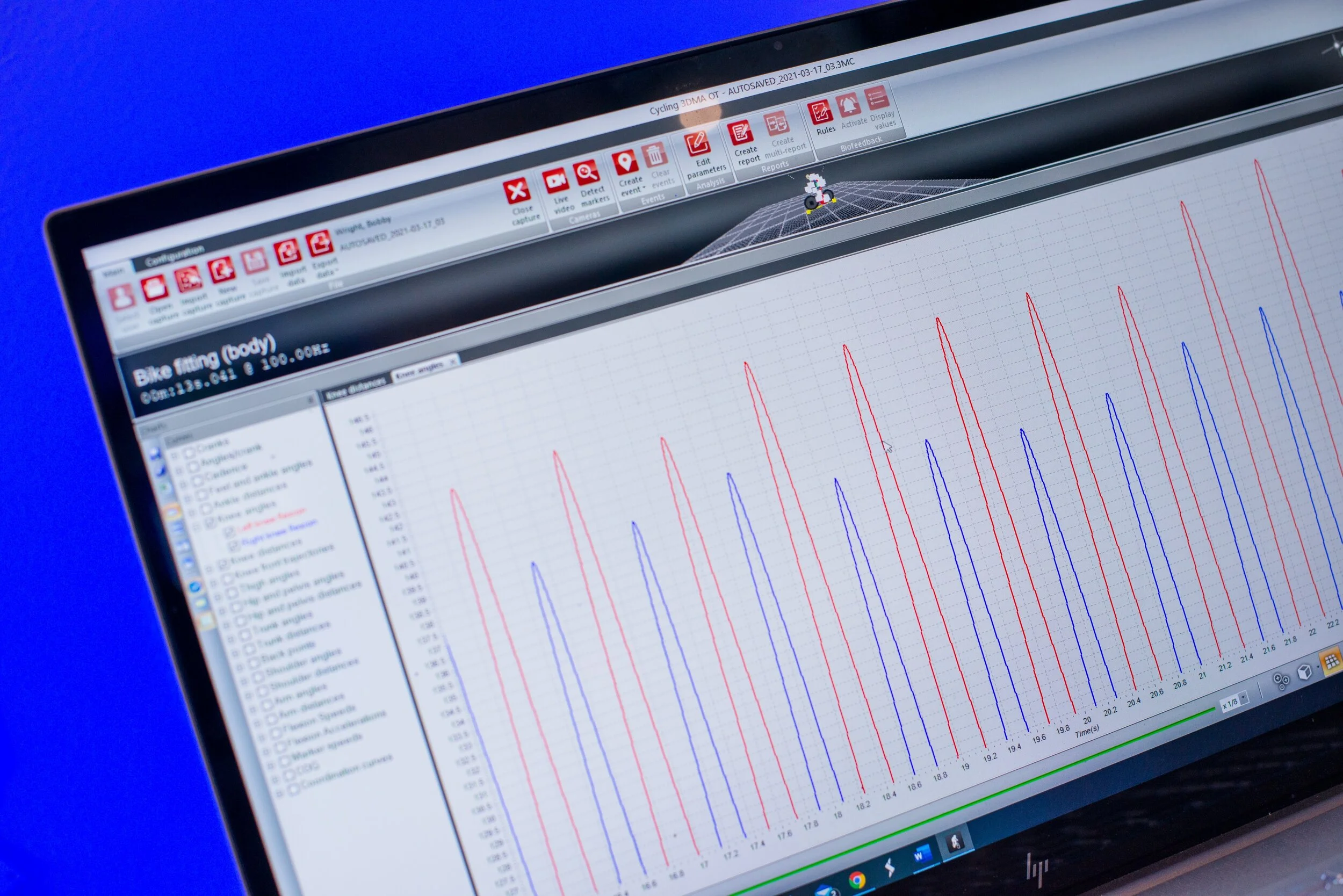 Integrated Biomechanics in Bike Fitting