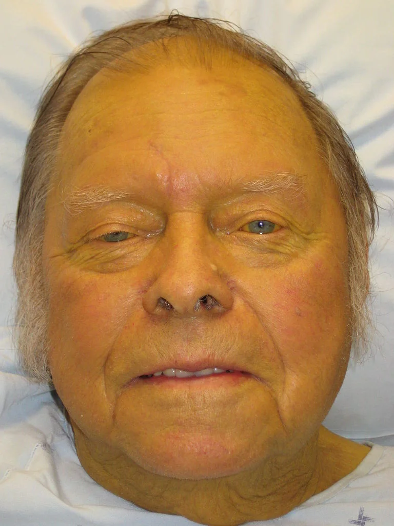 Author James Heilman, MD