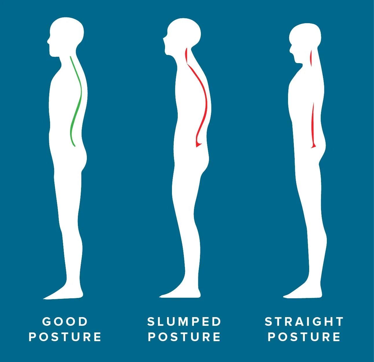 Observe the natural curvature of the spine that is allowed by the good posture. The straight spine on the right creates a rigid, military posture unsuitable for both piano playing and day-to-day life. 