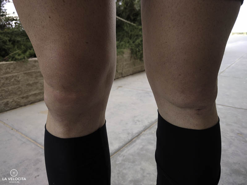 I'm pretty sure I used to have knee caps. 