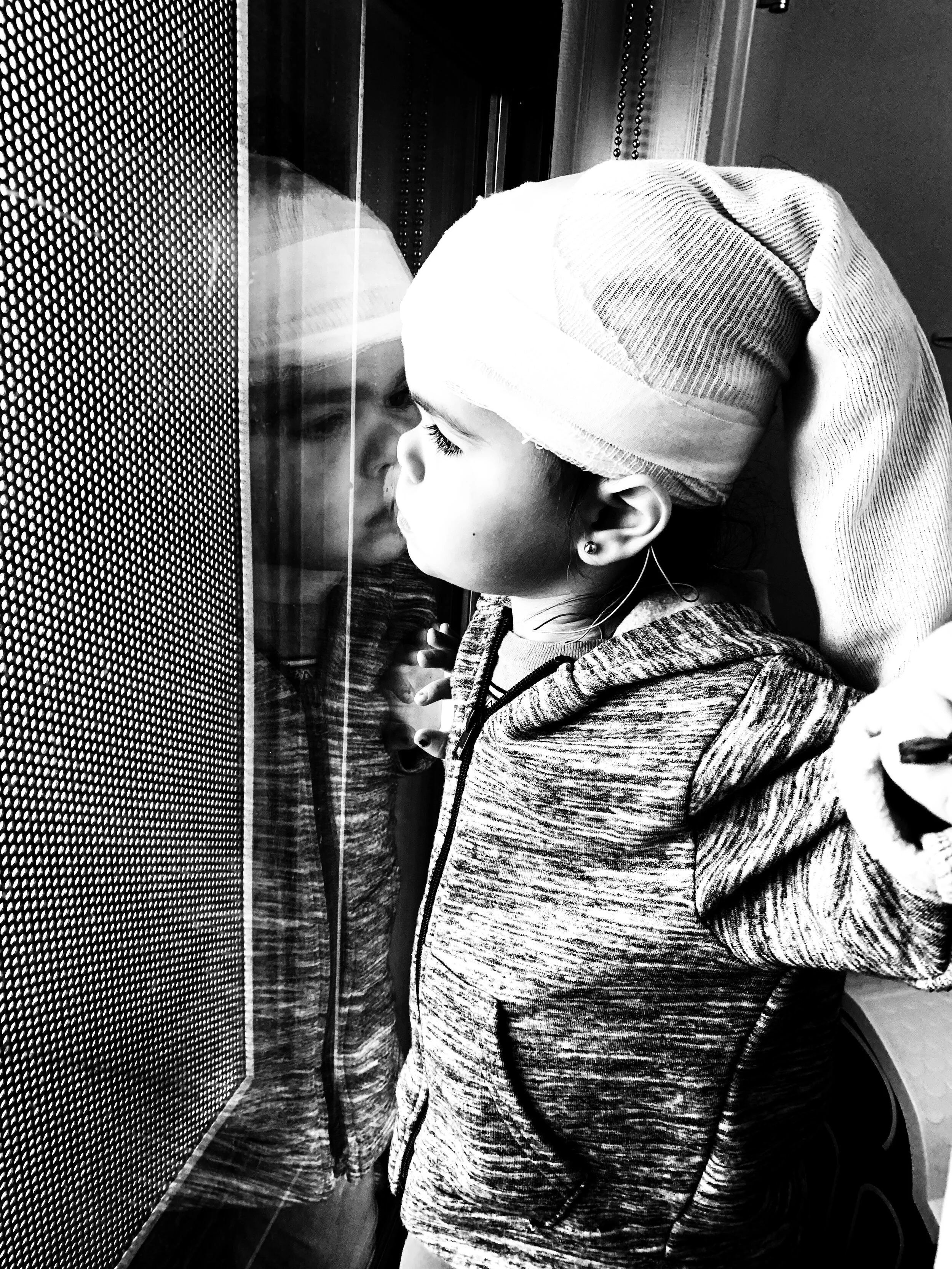 Galactosemia Seizure Discussion