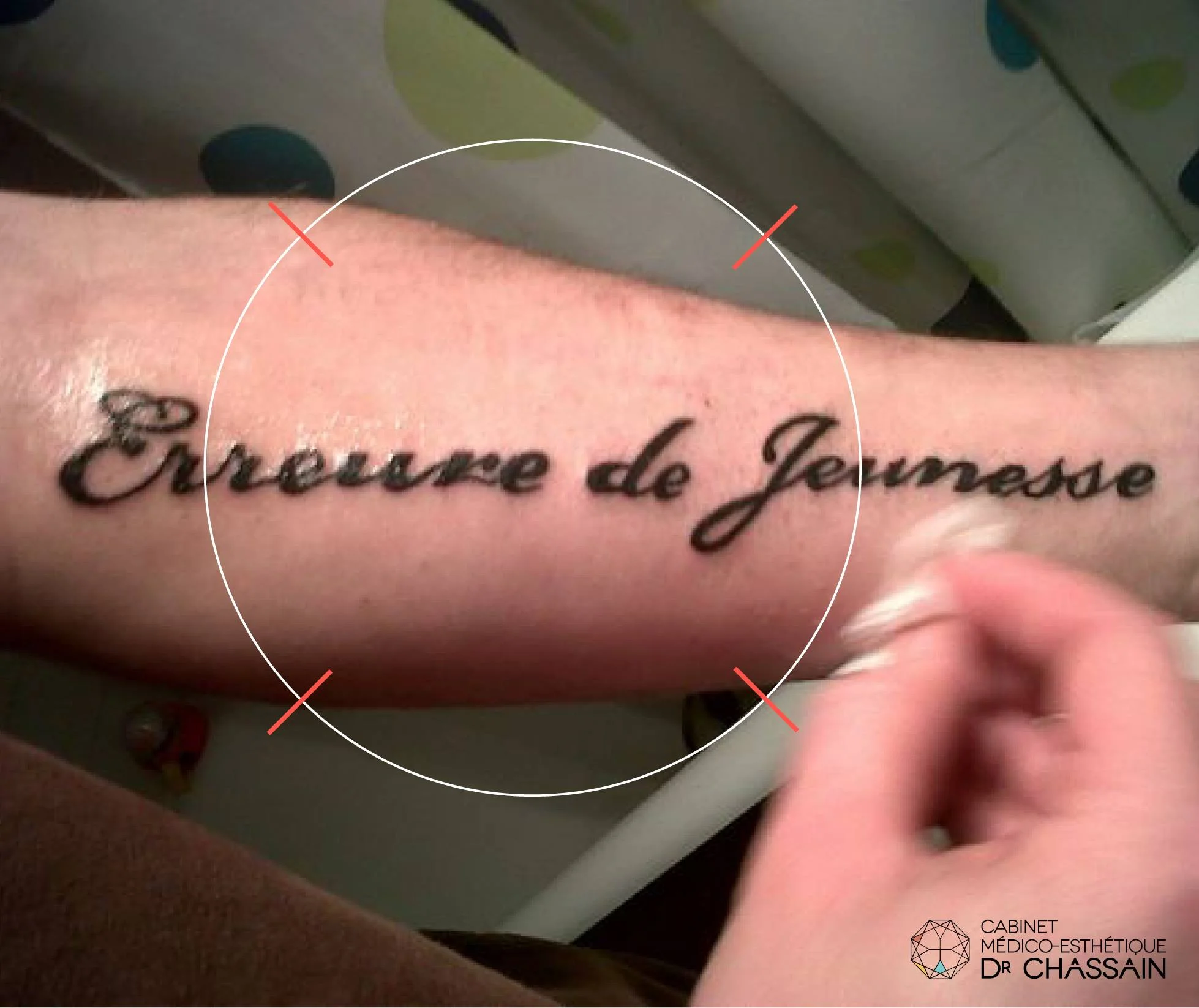 erreur de jeunesse.jpg