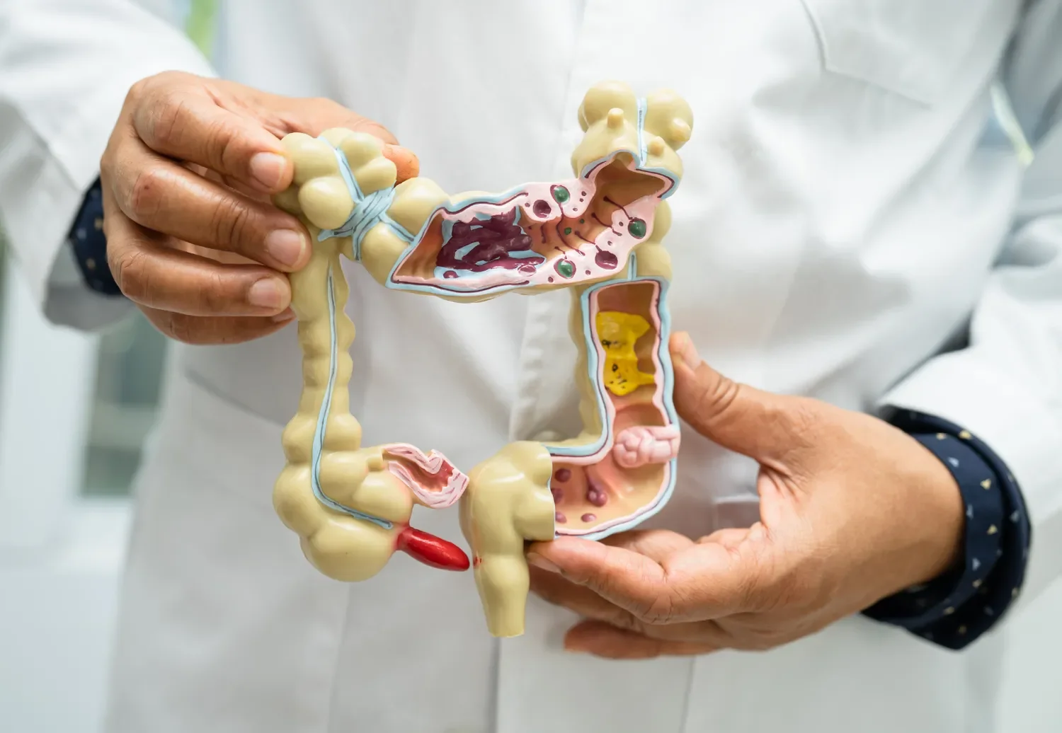 image of a man in a lab coat holding a model cross section of the large intestine.
