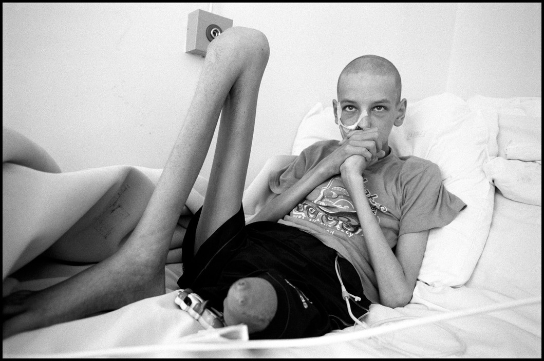  BELARUS. Minsk. Children's Cancer Hospital. Vova, 15years old, lost his left leg to cancer a year before this photo was taken. He's been in the hospital ever since. his cancer has spread and the doctor's have no treatment for it. 