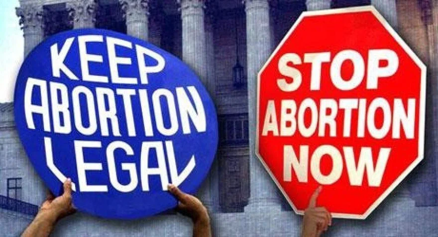 Abortion. Should it Be Legal? (Opinion) by Levi Laplante