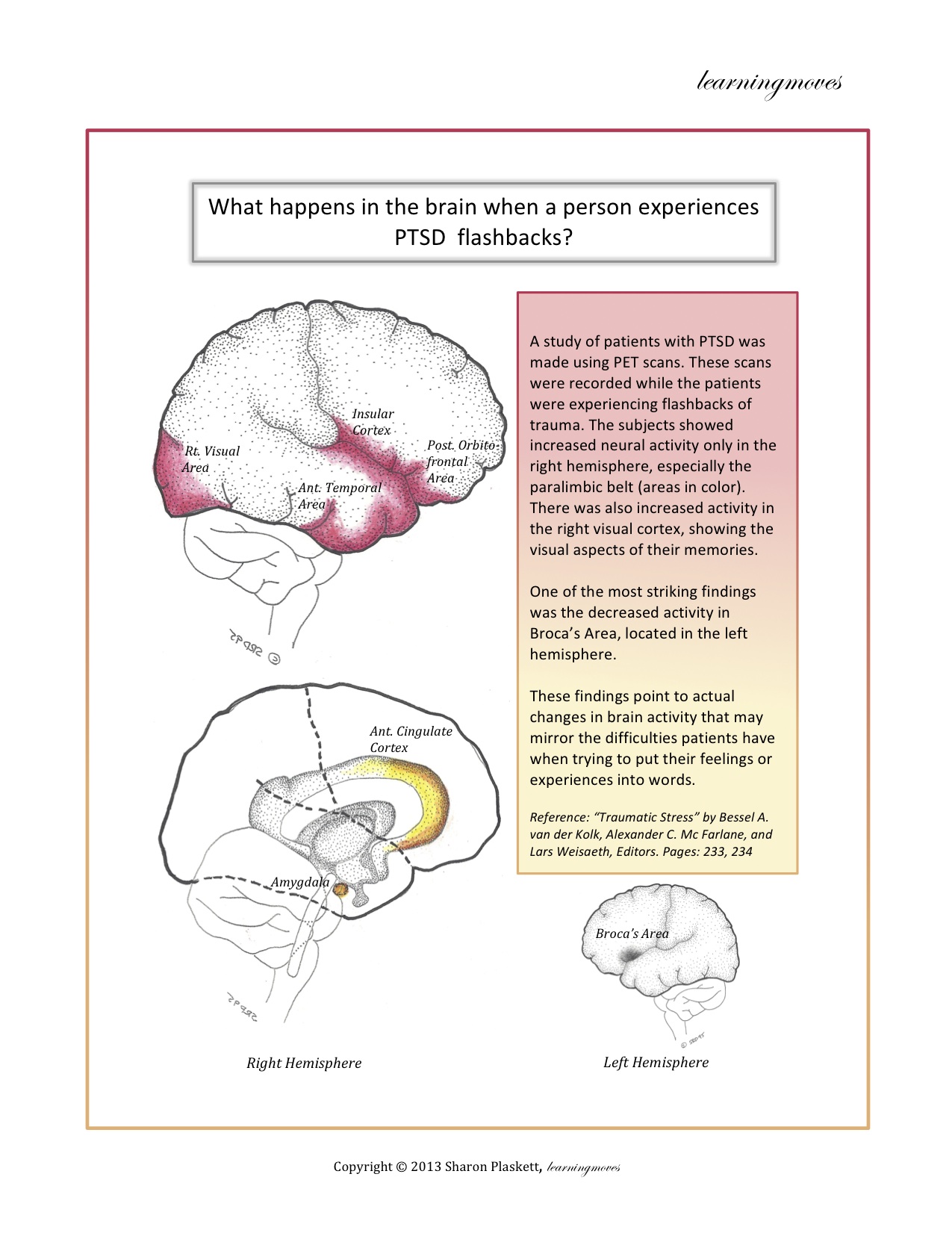 What happens in the Brain when a person experiences PTSD flashbacks.jpeg