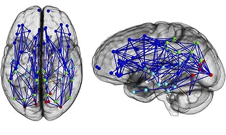 Men-women-brains-008.jpg