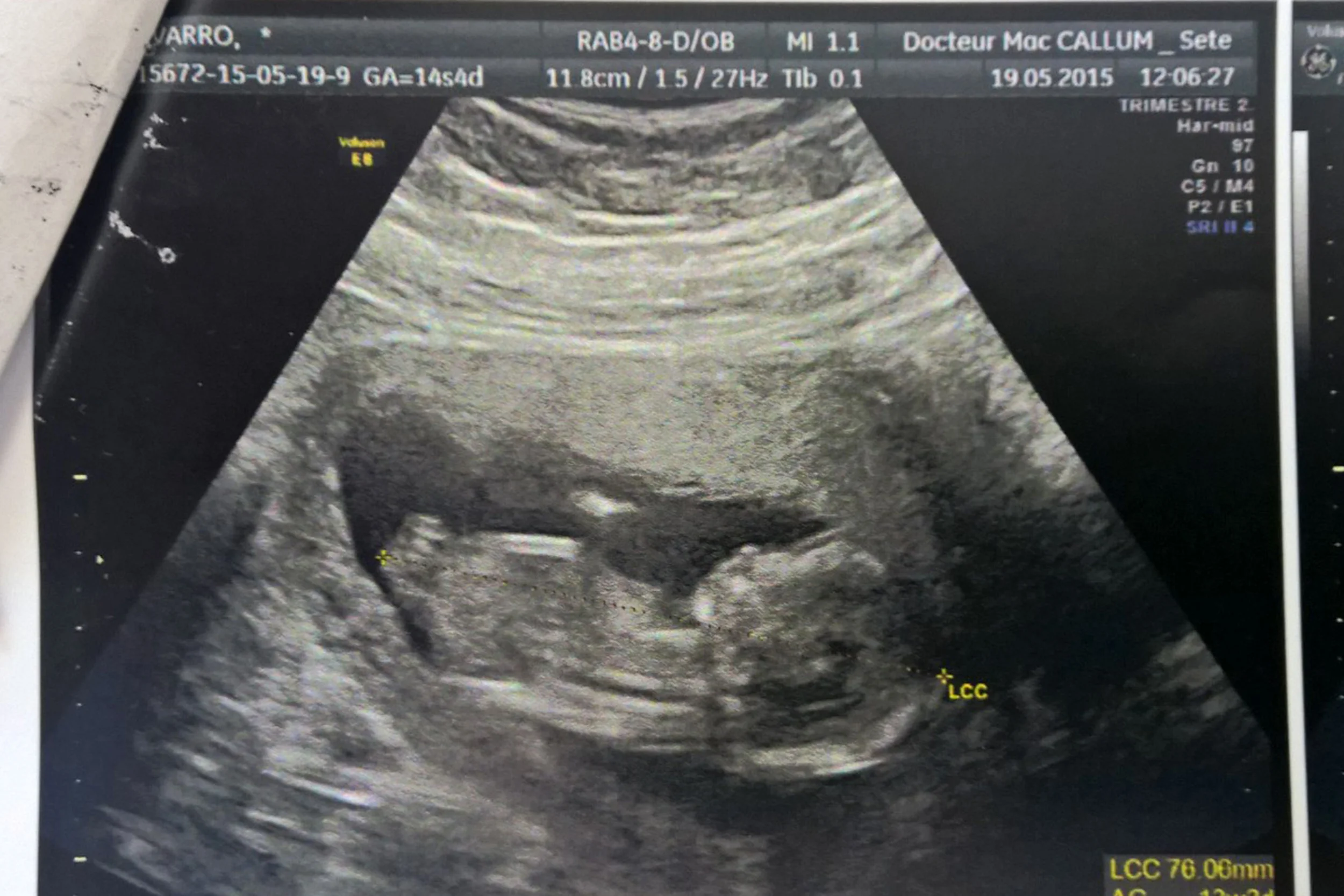 Jeudi 26 Mars 2015 : le premier jour du reste de notre vie