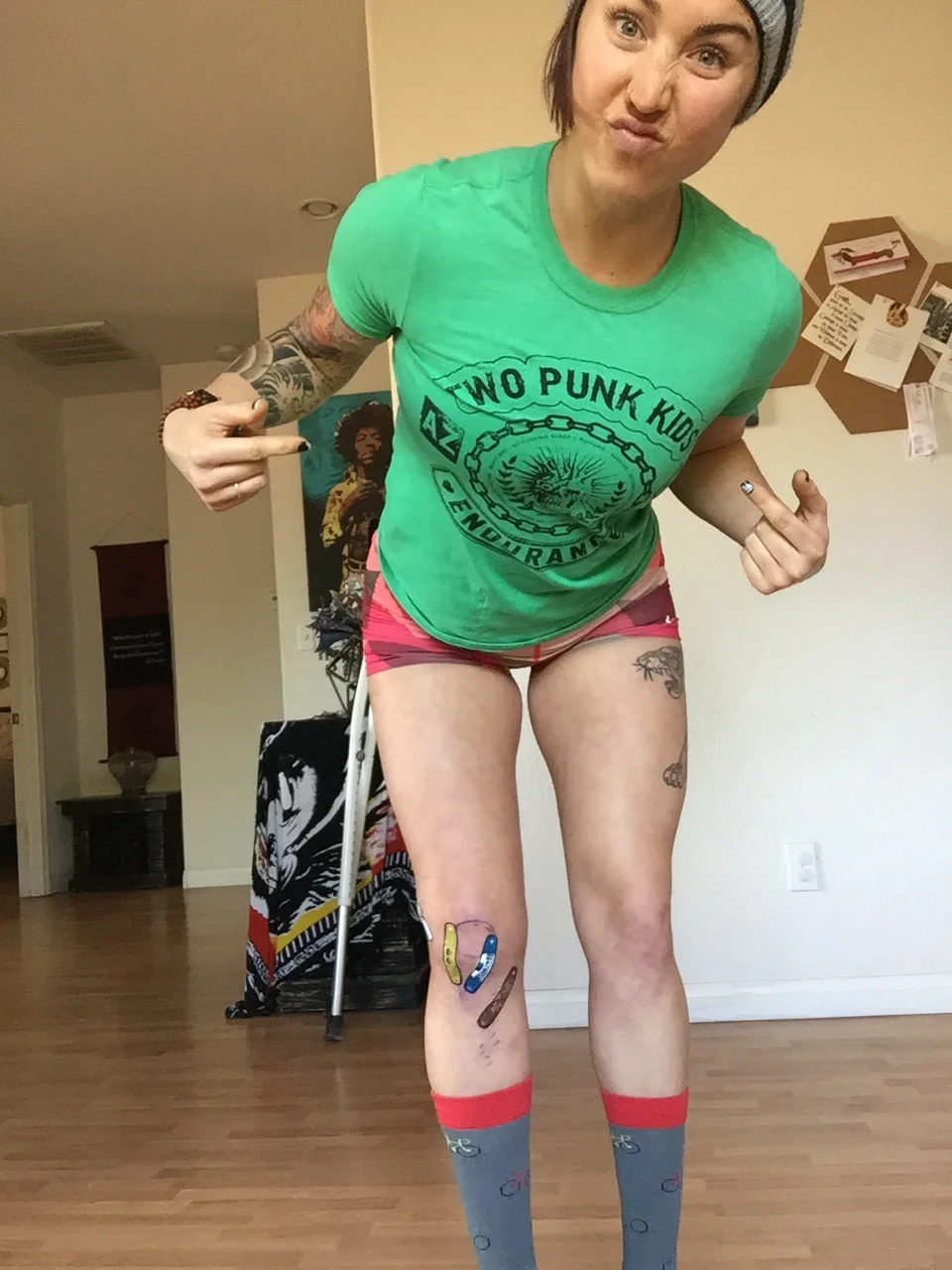 First day no crutches