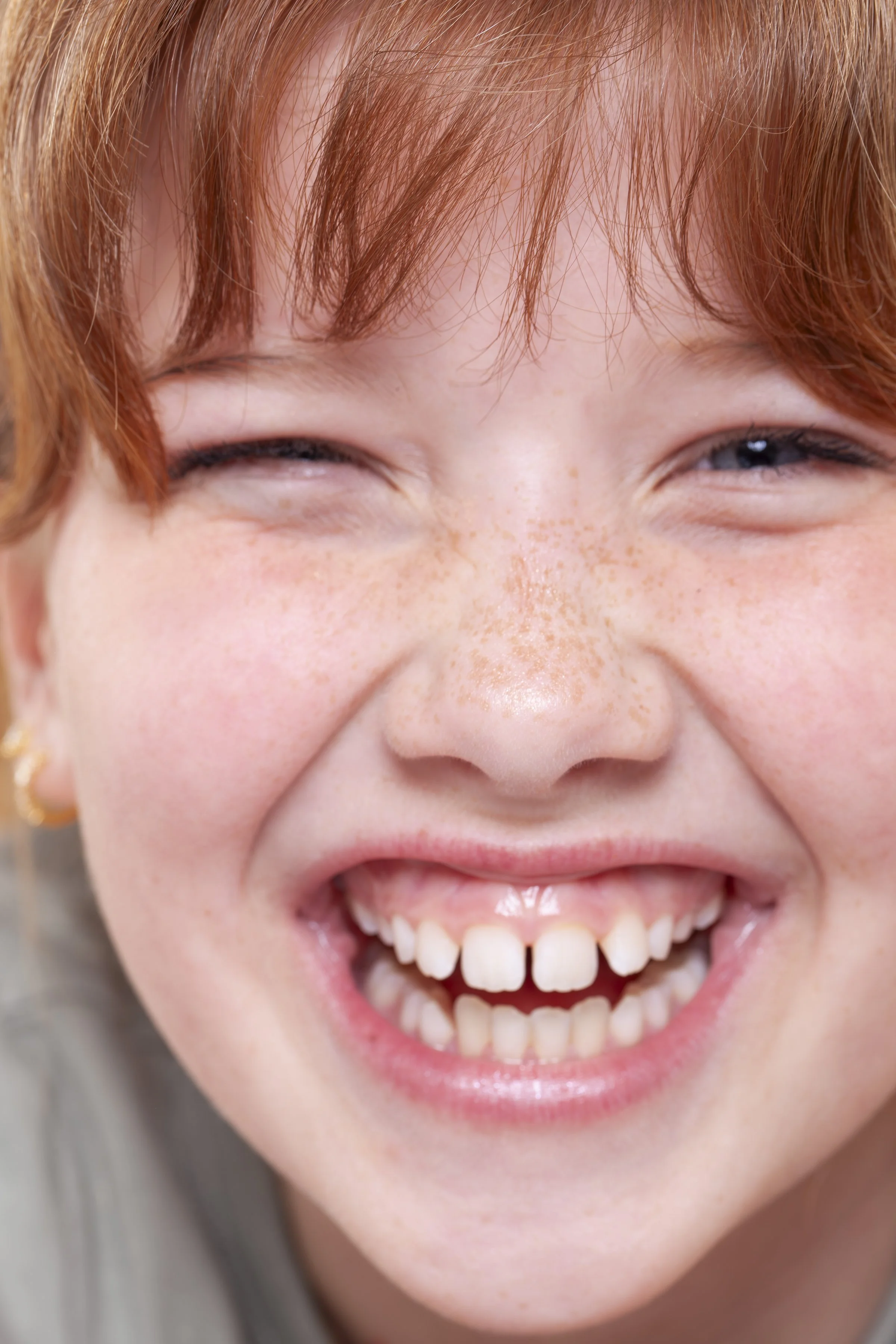 Close-up of a smiling young girl with missing front teeth and freckles, with her eyes squinting from smiling.
