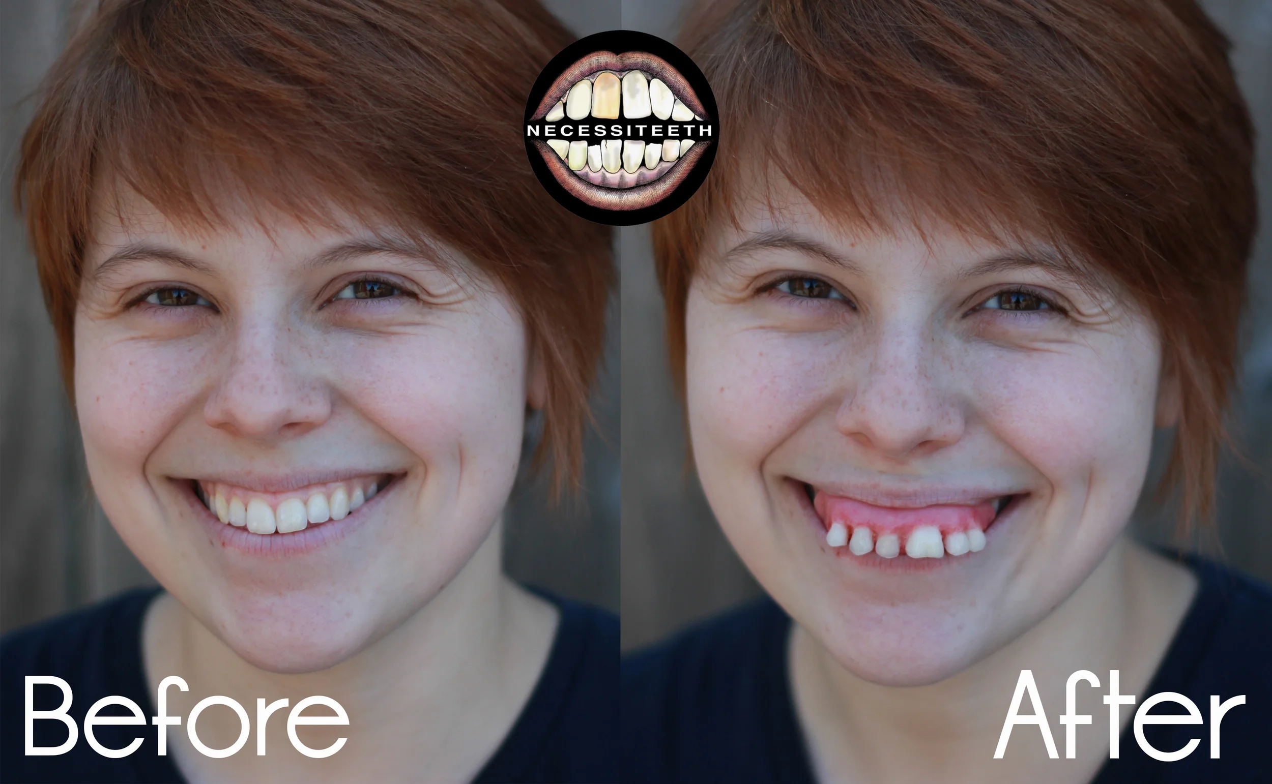 Annabeforeandafter.jpg