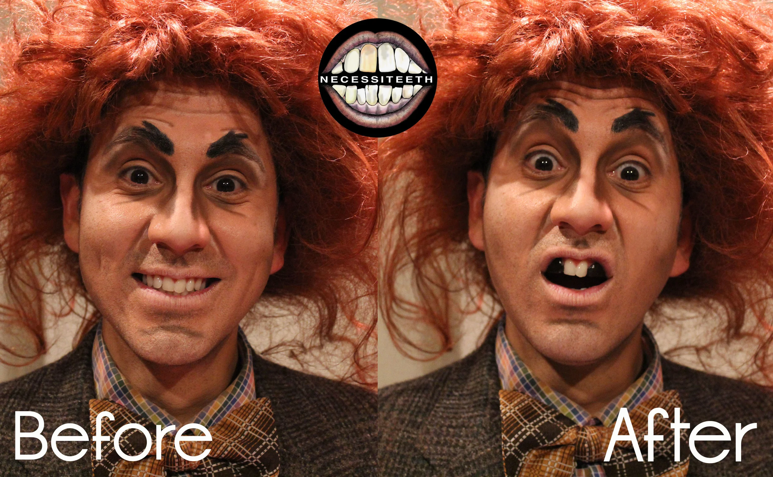 Robbiebeforeandafter.jpg