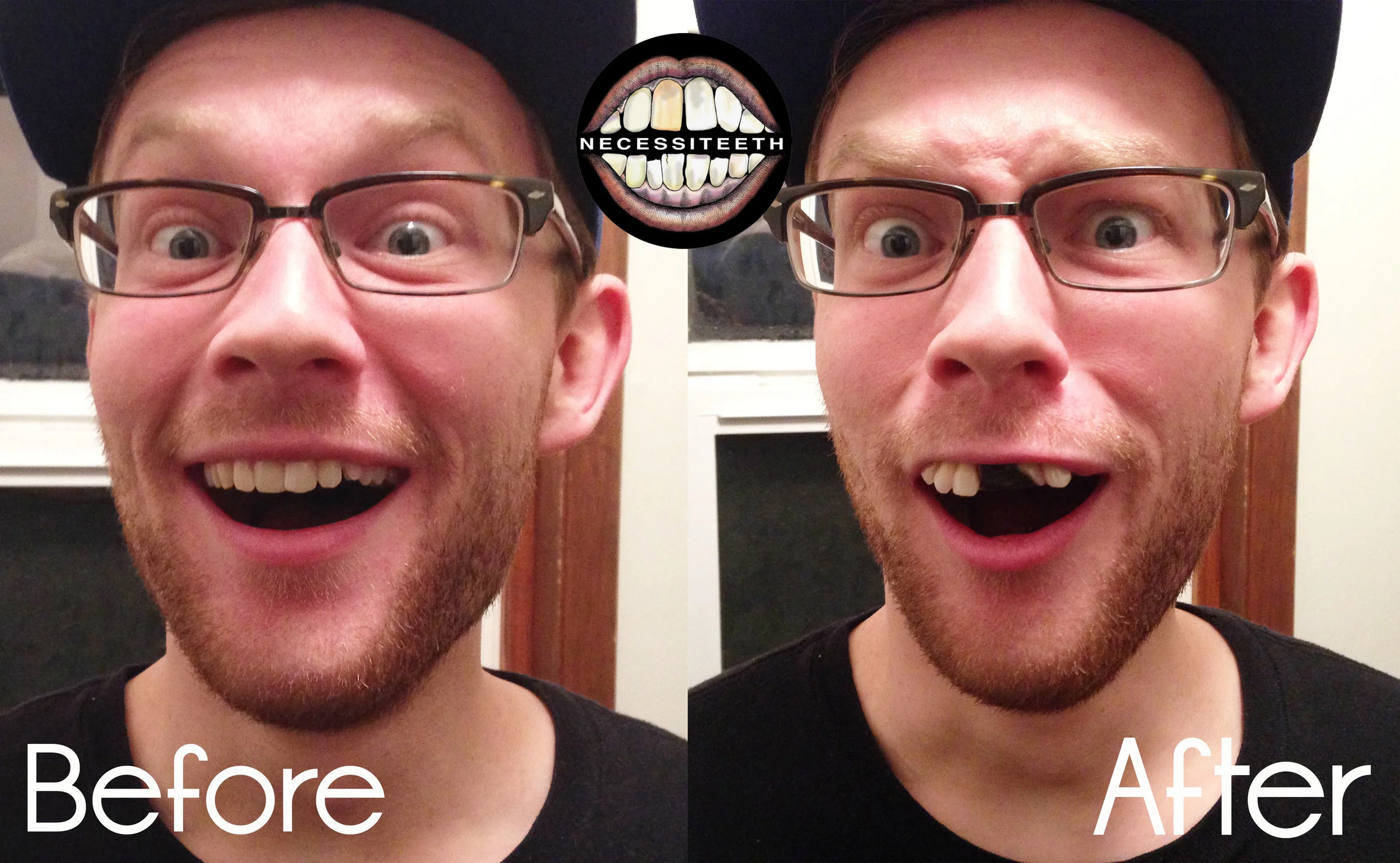 Nathanbeforeandafter.jpg