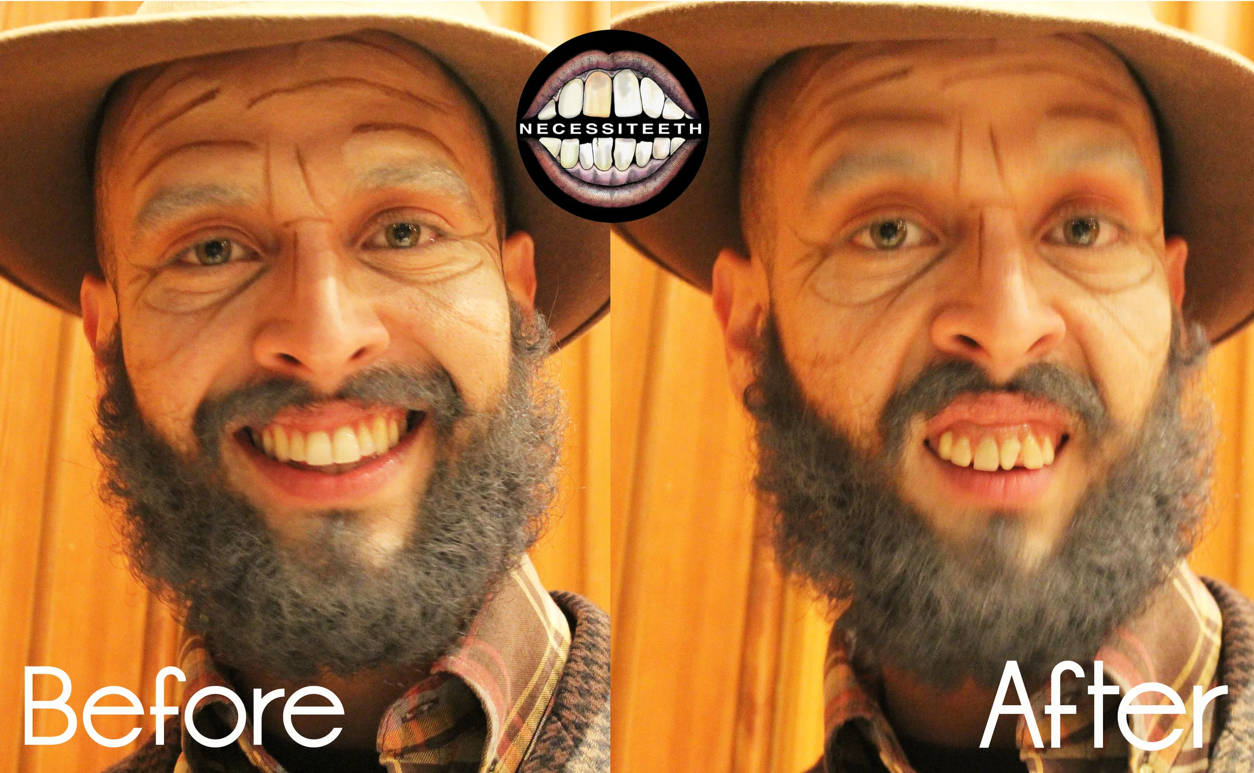Yanbeforeandafter.jpg