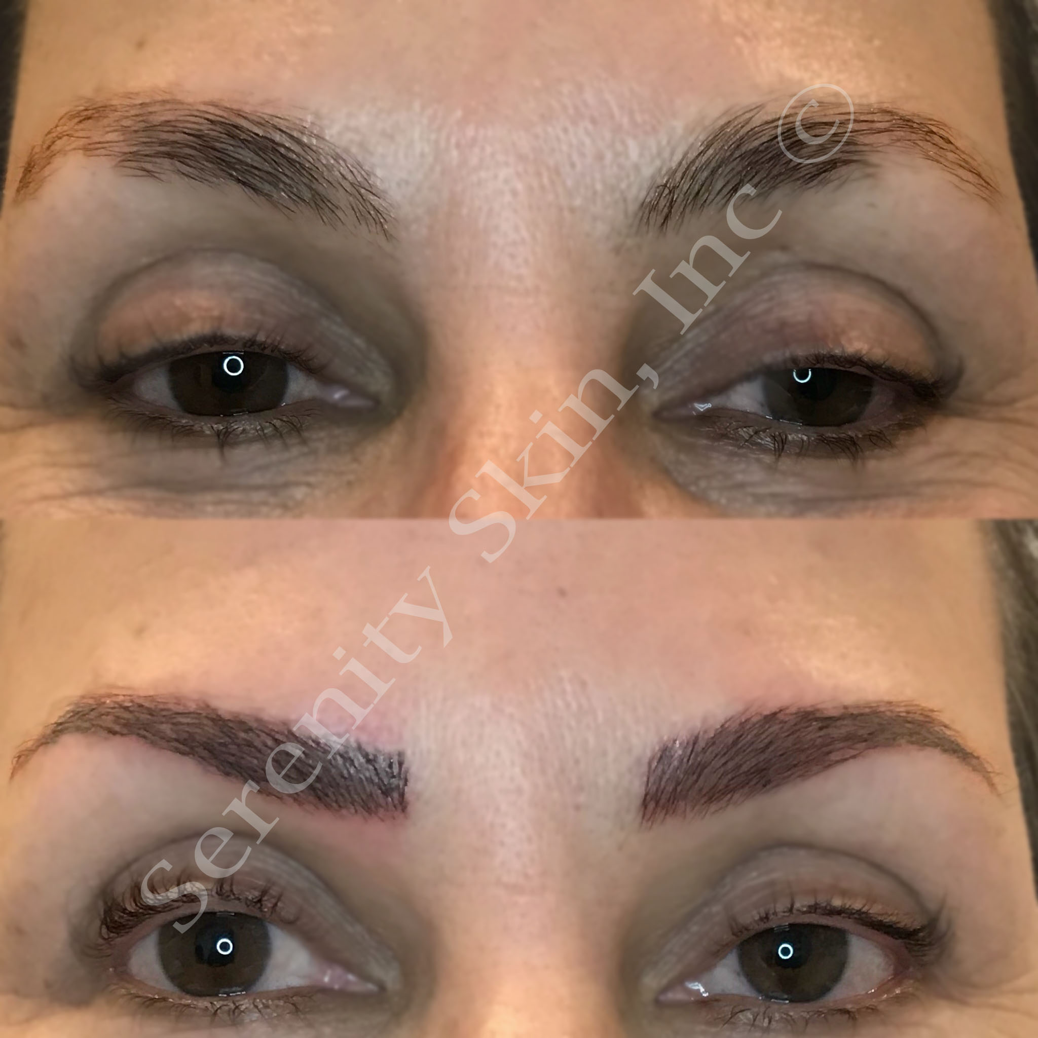 serenityskin_microblading_2