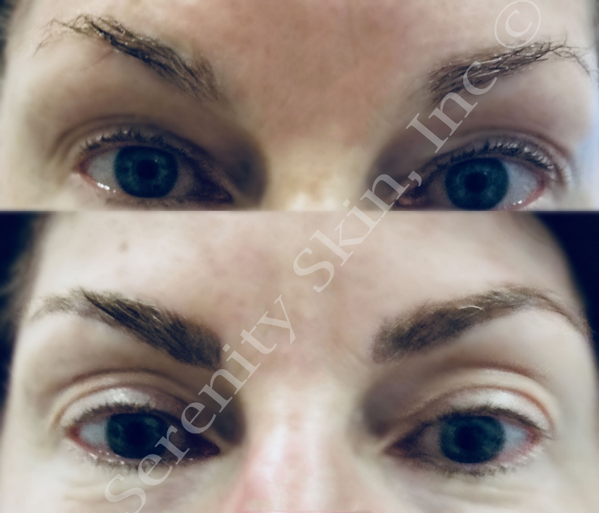 serenityskin_microblading_3