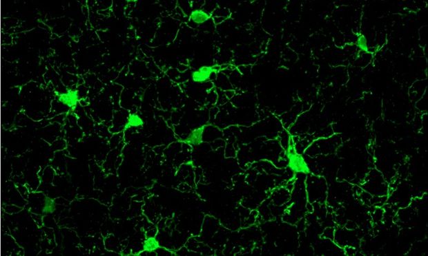 Brain cells called microglia (green) stained for lba1, a microglia marker (Photo Credit: Hannah Iaccarino, Anthony Martorell)