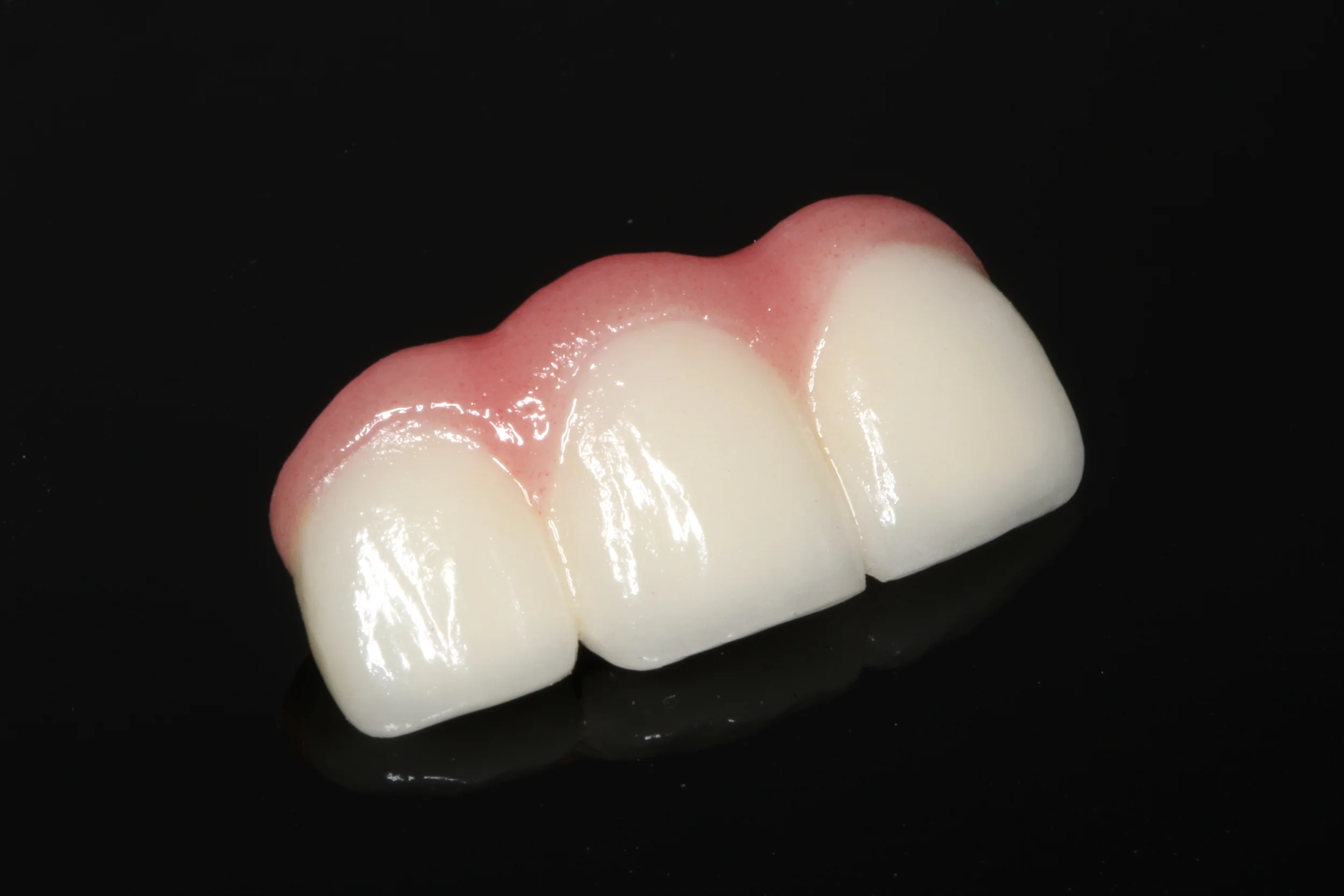 Prosthodontists & Maxillofacial Prosthetics Reno, NV Andresen DDS