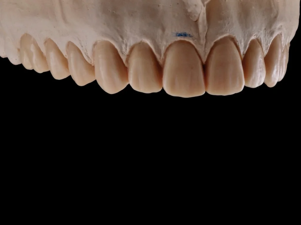 INCISAL EDGE.027.jpg