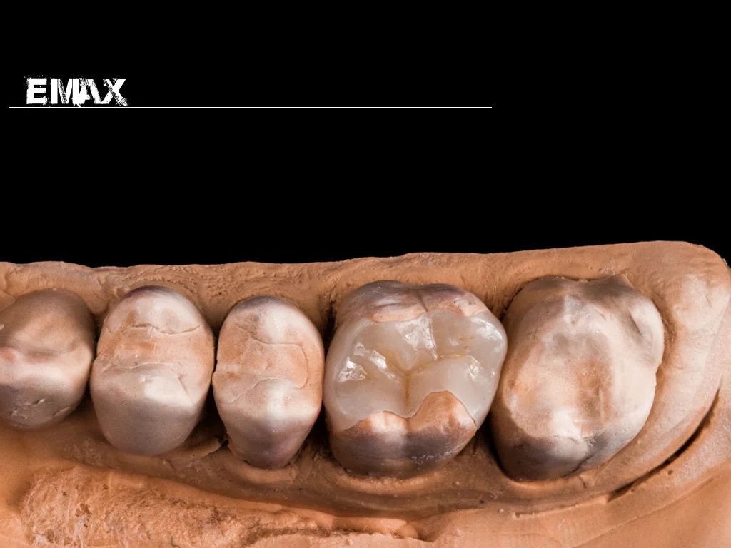 INCISAL EDGE.033.jpg