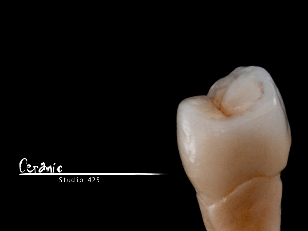 INCISAL EDGE 2.043.jpg
